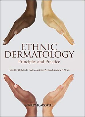Ethnic Dermatology: Principles and Practice 1st Edition, Kindle Edition