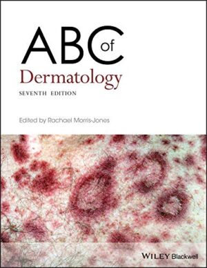 ABC of Dermatology (ABC Series) 7th Edition, Kindle Edition