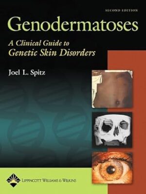 Genodermatoses: A Clinical Guide to Genetic Skin Disorders Second Edition