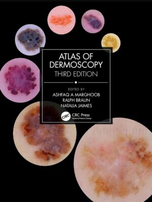Atlas of Dermoscopy: Third Edition (Copy)