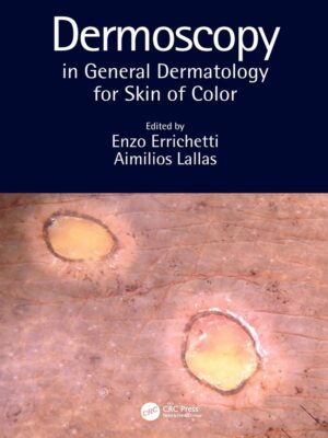 Dermoscopy in General Dermatology for Skin of Color Kindle Edition