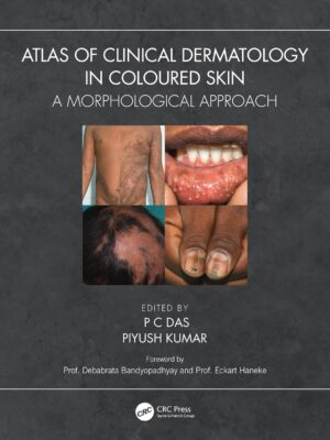 Atlas of Clinical Dermatology in Coloured Skin: A Morphological Approach 1st Edition, Kindle Edition
