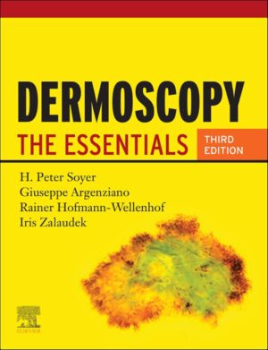 Dermoscopy: The Essentials 3rd Edition, Kindle Edition