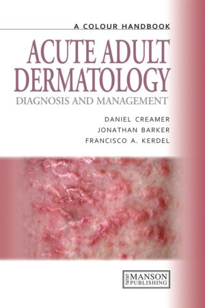 Acute Adult Dermatology: Diagnosis and Management: A Colour Handbook (Medical Color Handbook Series) Kindle Edition