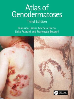 Atlas of Genodermatoses 3rd Edition, Kindle Edition