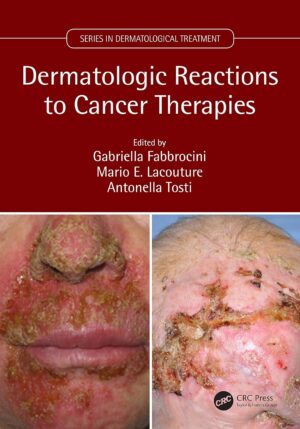 Dermatologic Reactions to Cancer Therapies (Series in Dermatological Treatment) 1st Edition, Kindle Edition