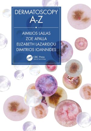 Dermatoscopy A-Z 1st Edition, Kindle Edition