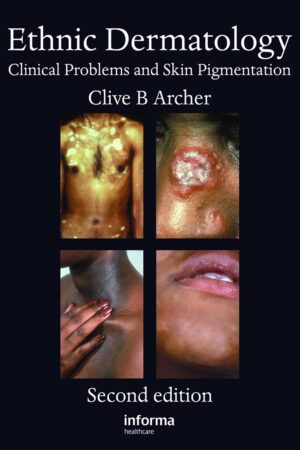 Ethnic Dermatology: Clinical Problems and Skin Pigmentation 2nd Edition, Kindle Edition