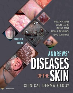 Andrews' Diseases of the Skin: Clinical Dermatology 13th Edition, Kindle Edition