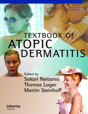 Textbook of Atopic Dermatitis (Series in Dermatological Treatment 3) 1st Edition, Kindle Edition