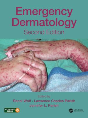 Emergency Dermatology 2nd Edition, Kindle Edition