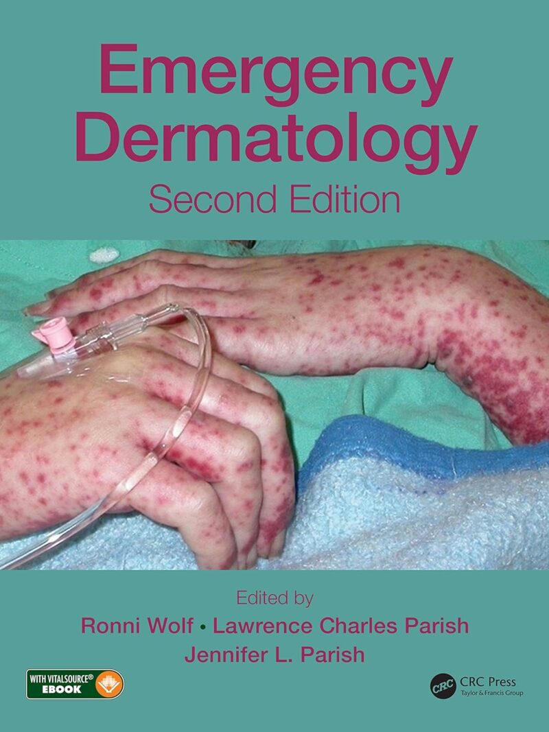 Emergency Dermatology 2nd Edition, Kindle Edition
