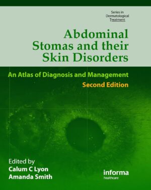 Abdominal Stomas and Their Skin Disorders 2nd Edition, Kindle Edition