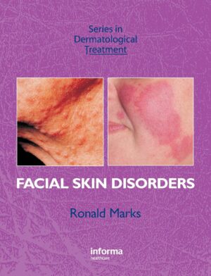 Facial Skin Disorders (Series in Dermatological Treatment) 1st Edition, Kindle Edition
