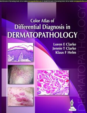 Color Atlas of Differential Diagnosis in Dermatopathology 1st Edition, Kindle Edition