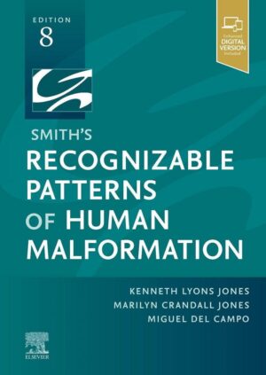Smith’s Recognizable Patterns of Human Malformation: Expert Consult – Online and Print