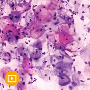 Oakstone Gynecologic Pathology