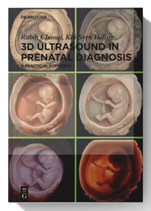 3D Ultrasound in Prenatal Diagnosis: A Practical Approach 2nd edition