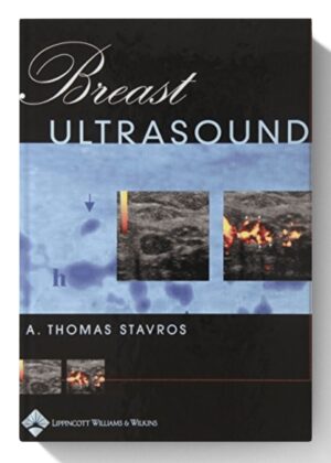 Breast Ultrasound 1st Edition