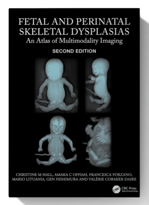 Fetal and Perinatal Skeletal Dysplasias: An Atlas of Multimodality Imaging 2nd Edition