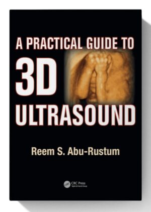 A Practical Guide to 3D Ultrasound