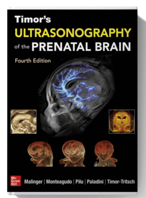 Timor’s Ultrasonography of the Prenatal Brain (4th Edition)
